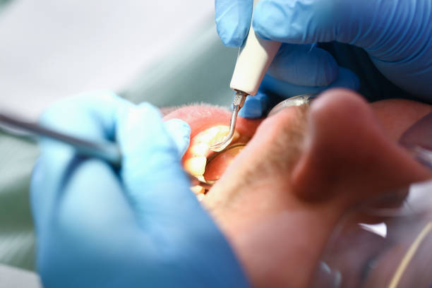 Best Weekend Emergency Dentist in Junction City, KS